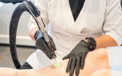 Your guide to laser treatments in Stockholm